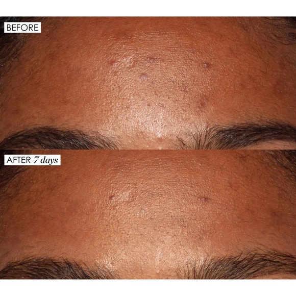 NEW Sunday Riley Good Genes All-In-One Lactic Acid Treatment - Picture 7 of 13